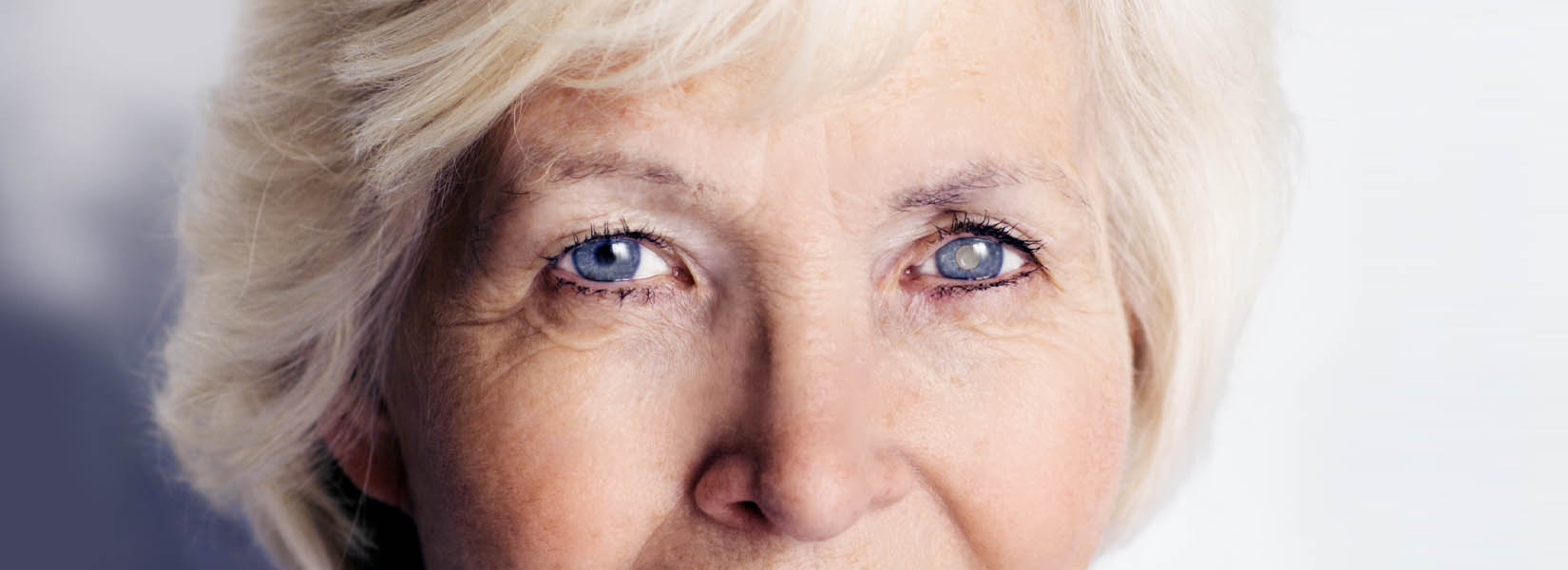 Cataract Surgery in Erie
